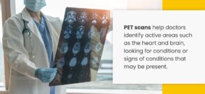 PET Scans Help Doctors identify Active Areas Such as The Heart and Brain for Conditions